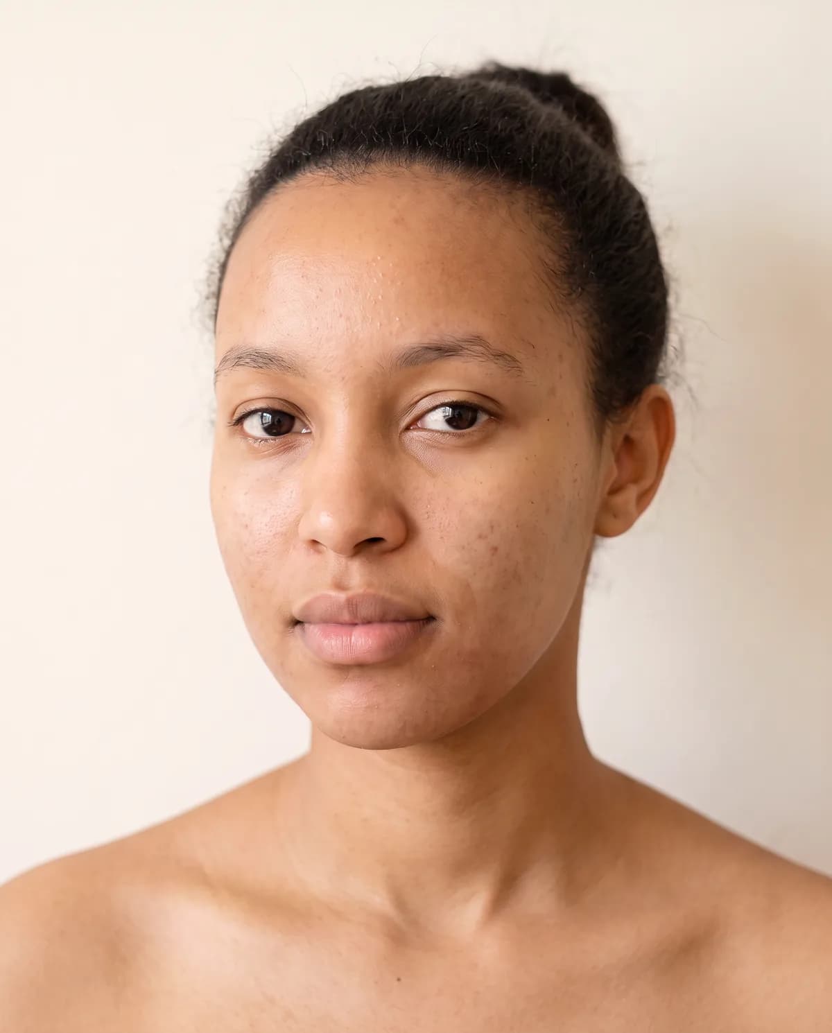 After: a young woman in her early twenties, photographed straight on in daylight