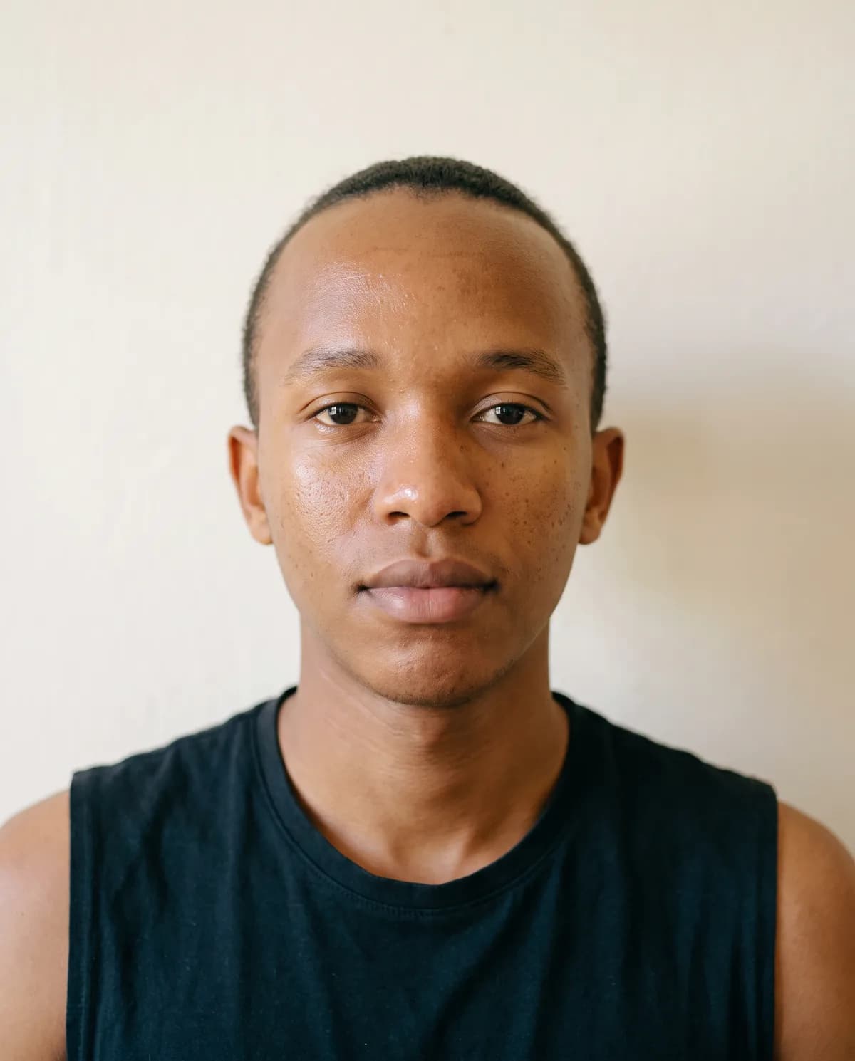 Before: a young man in his early twenties, photographed straight on in daylight